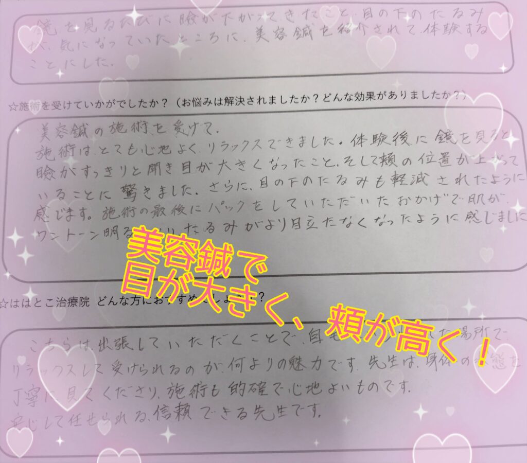 美容鍼感想2